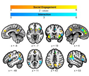 PT-141 Bramalanotide brain pathway visual