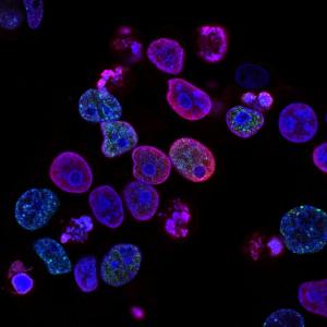 CJC-1295 No DAC vs DAC: What's the Difference and Why It Matters in Research 2 The pulsatile vs sustained GH secretion distinction has significant implications for experimental design in GH axis research.